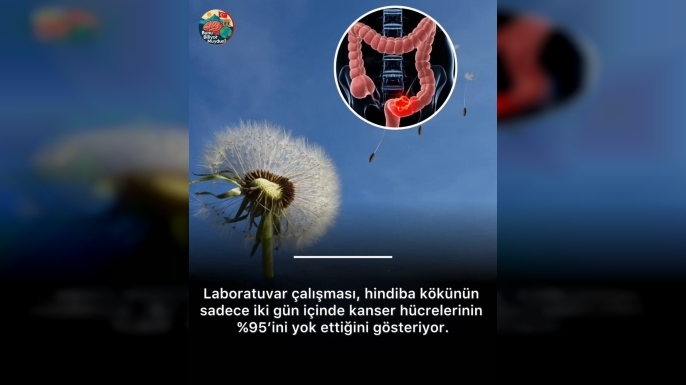 Hindiba Kökü Kolorektal Kanseri Hücrelerini %95 Yok Edebiliyor