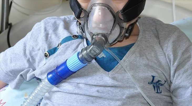Kistik fibrozis belirtileri her hastada aynı değildir. Hastalığın ciddiyetine göre farklı farklı belirtiler görülür. Hatta aynı kişide bile belirtiler zaman içinde kötüye ya da iyiye doğru gidiş gösterebilir. Bazı insanlar ergenlik ya da yetişkinlik dönemine kadar herhangi bir belirti yaşamazlar.